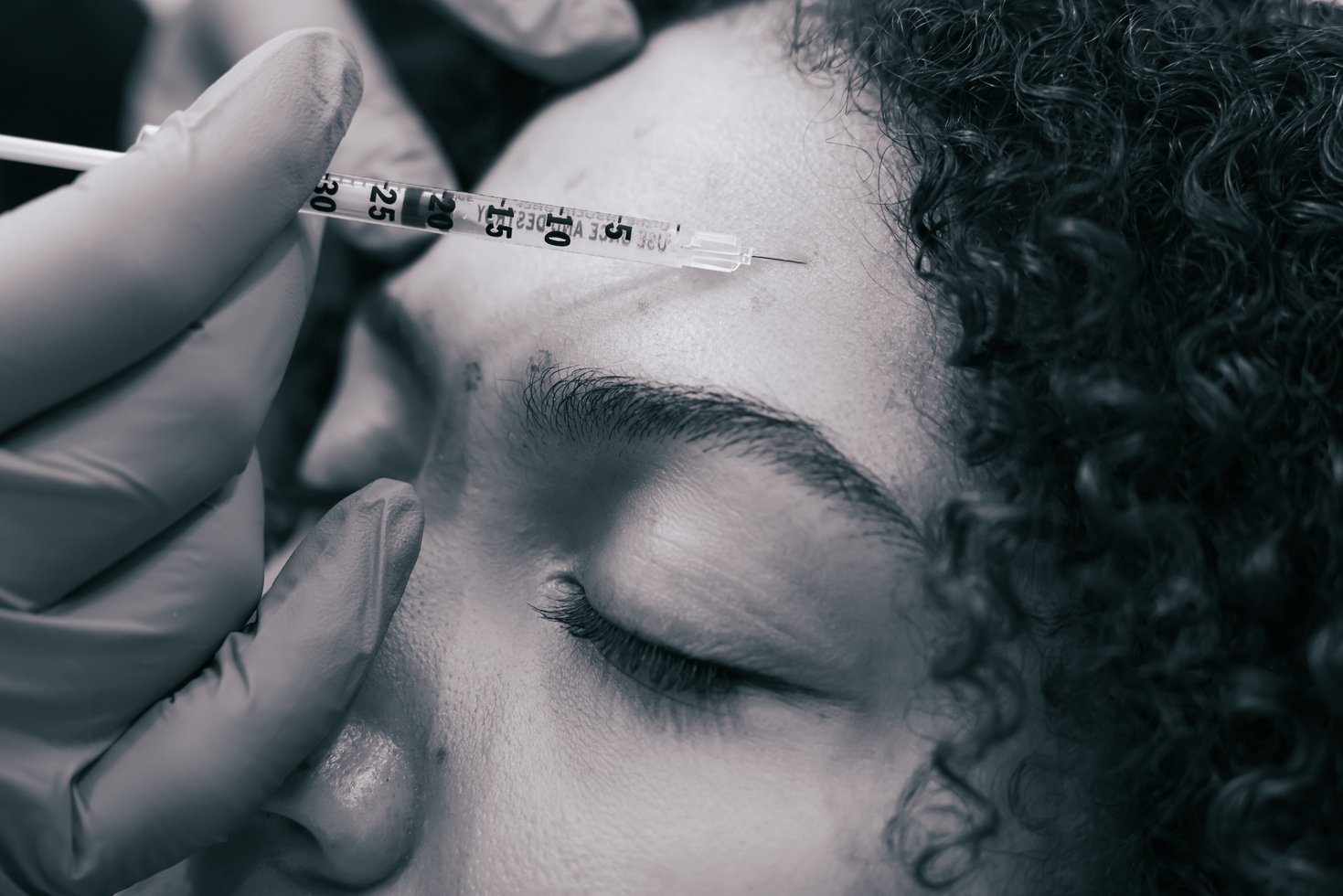 Close-up of a medspa worker using a needle to inject Botox in a client's forehead.