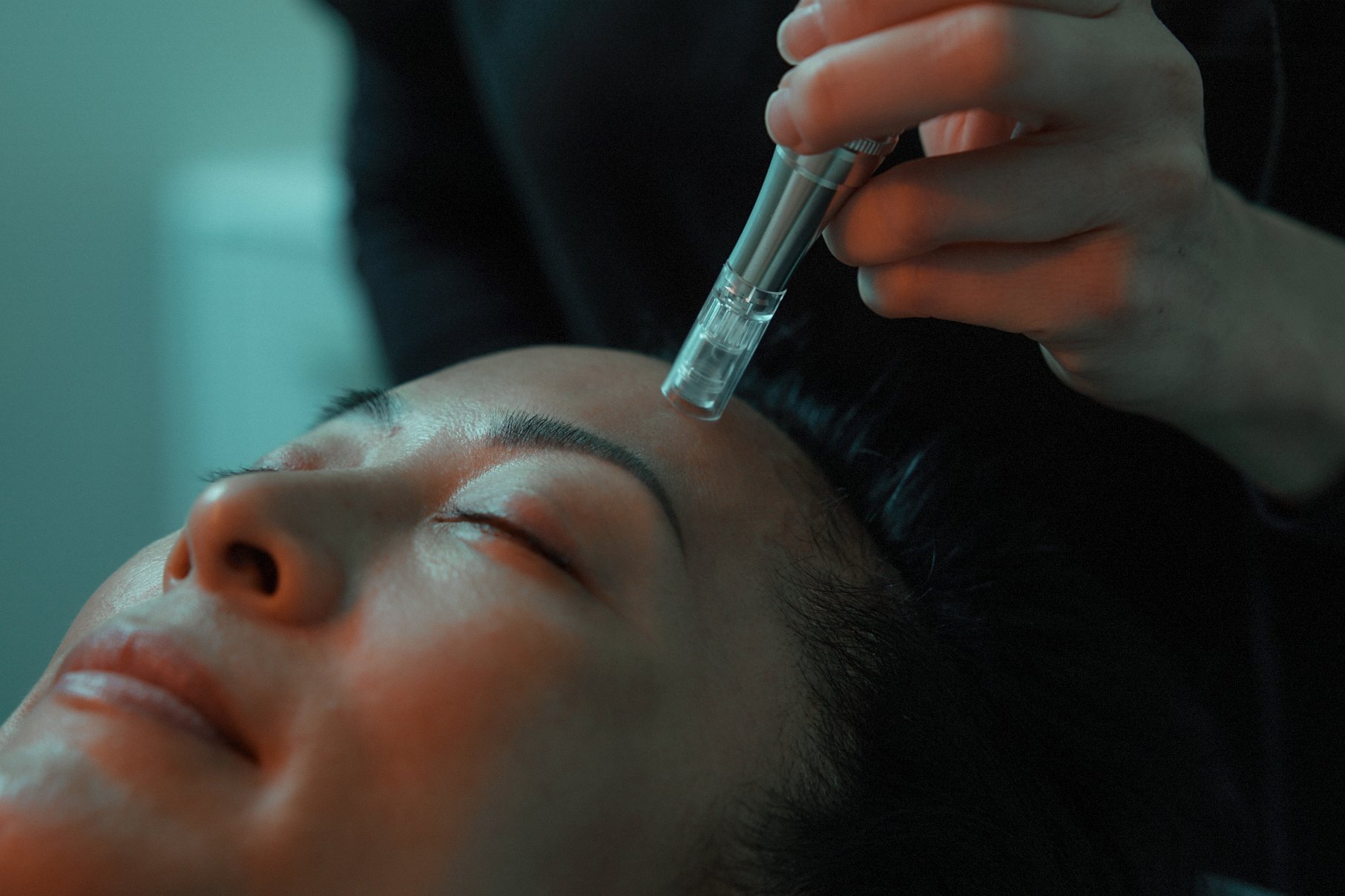 Close-up of a woman undergoing a medical spa treatment for her face.