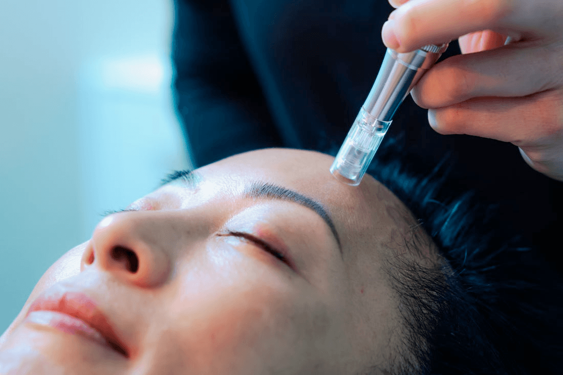 A close-up of a woman's face as she receives a skin care treatment.